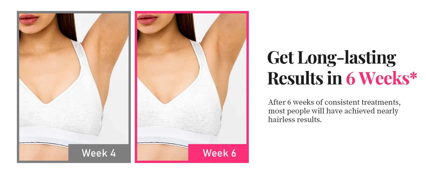 990000   Flashes Épilation au laser pour femmes et hommes Épilation IPL Corps Bikini et zones du visage Épilation permanente indolore