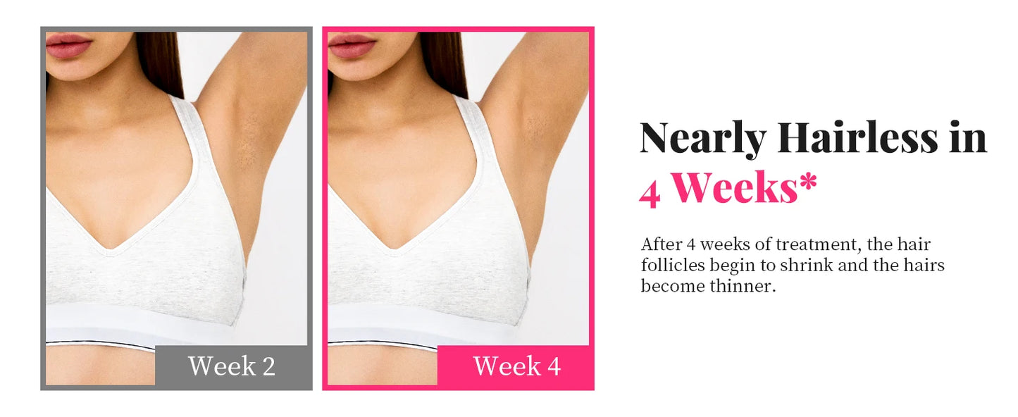 990000   Flashes Épilation au laser pour femmes et hommes Épilation IPL Corps Bikini et zones du visage Épilation permanente indolore